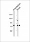 PCCA Antibody (Center)